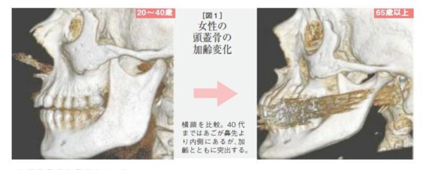 頭蓋骨崩れ が 老け顔の原因 宇山恵子 恵風ホームページ 医療 健康 美容についてのコラム